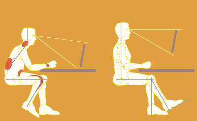 deux postures de travail devant écran 1 sollicitante et 1 ergonomique